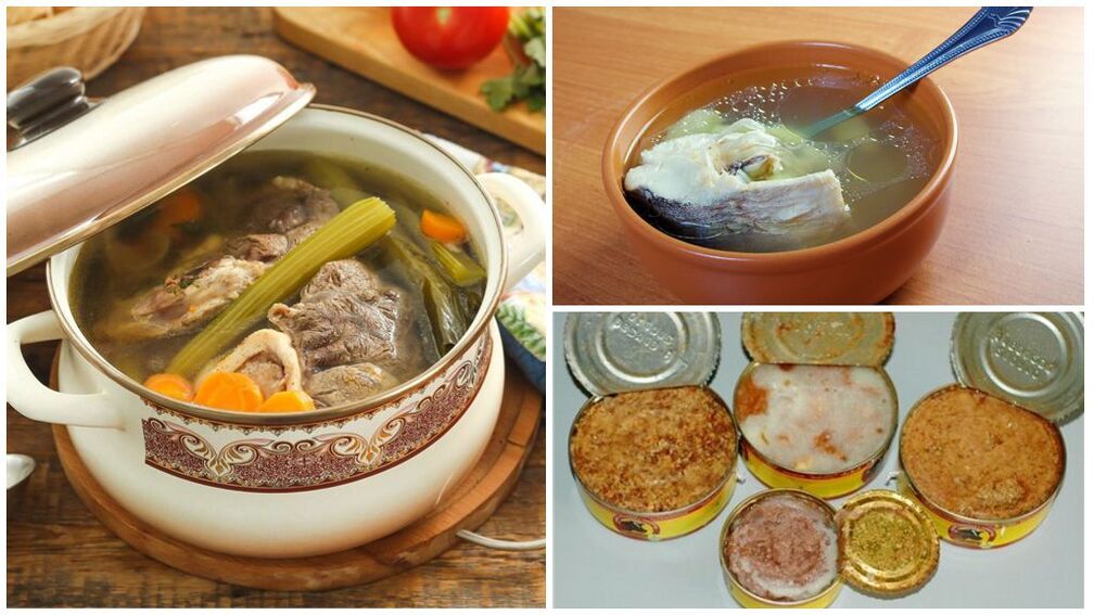 痛风的禁食——丰富的肉和鱼汤、罐头食品